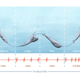 Diagram showing the blue whale’s heart rate as it goes about its feeding routine.